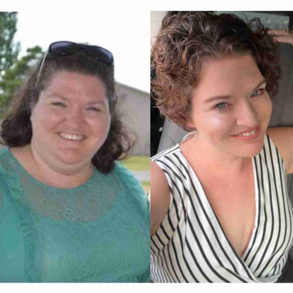 Danielle before and after her weight loss surgery in Mexico
