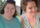 Danielle before and after her weight loss surgery in Mexico