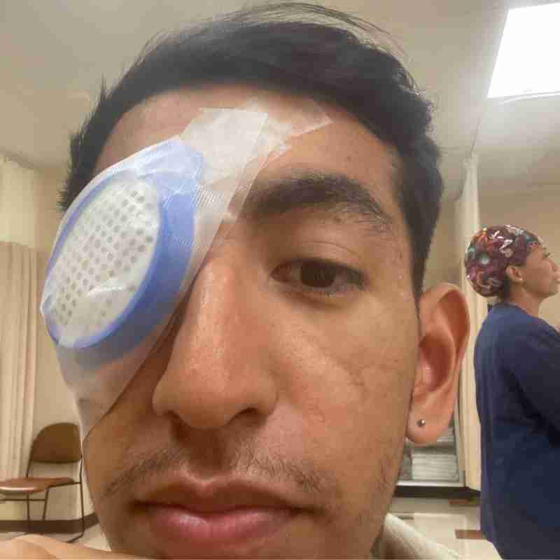 A photo of Alan after one of his surgeries due to retinal detachment.