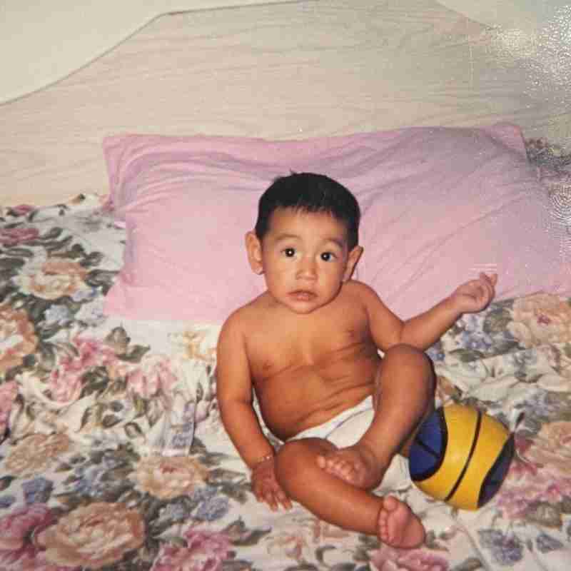 A photo of Alan as a baby, where his sunken chest is visible.