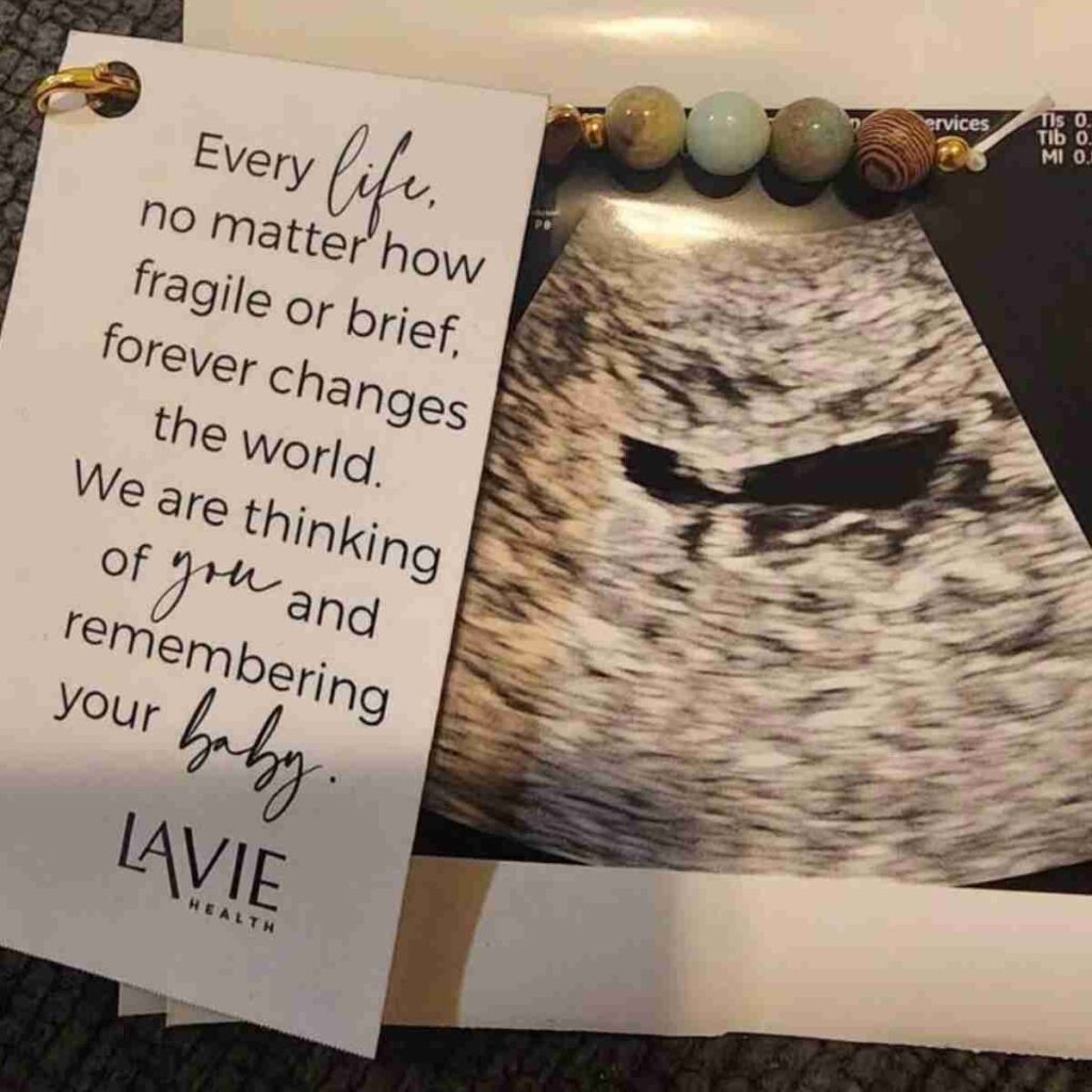 A photo of Josie's ultrasound from the baby she miscarried.