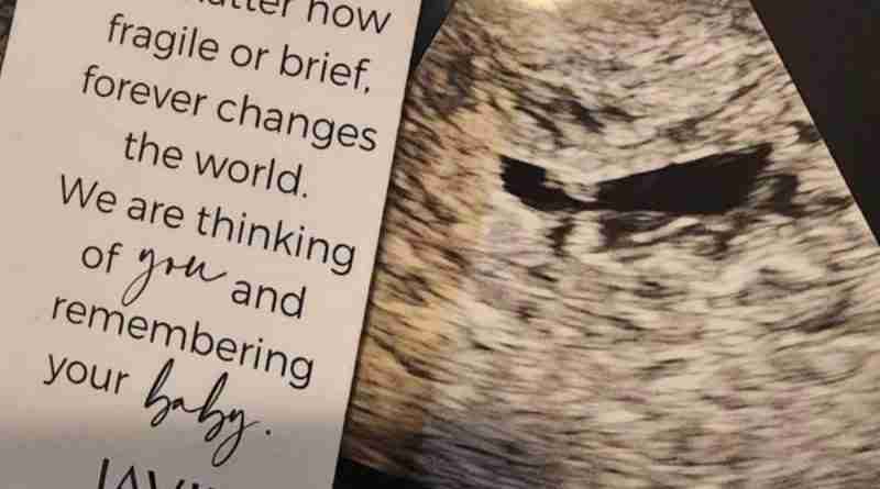 A photo of Josie's ultrasound from the baby she miscarried.