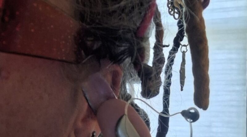 A photo of the author showing how the device to treat her impaired hearing gets stuck in her hair.