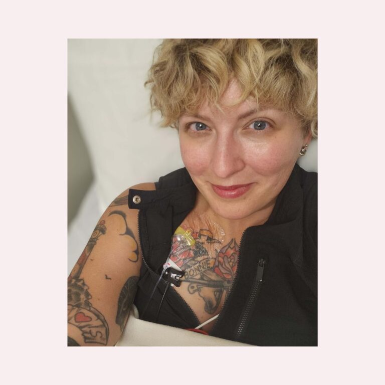 Life With Kidney Disease: This Is Living—Even Now 1 A photo of the author with a PIC line, a visual representation of life with chronic kidney disease.