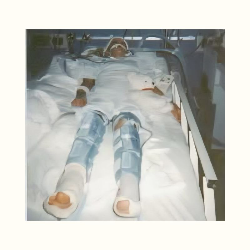 Life With Kidney Disease: This Is Living—Even Now 4 A photo of the author in the hospital, part of her life with chronic kidney disease. While on life support for pneumonia at age 12, doctors discovered Tiffini's cystic kidneys and diagnosed her with PKD.